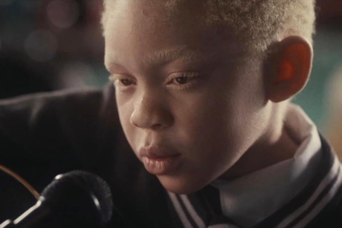 Histoire vraie : Un chanteur albinos zambien inspire un drame sur Netflix