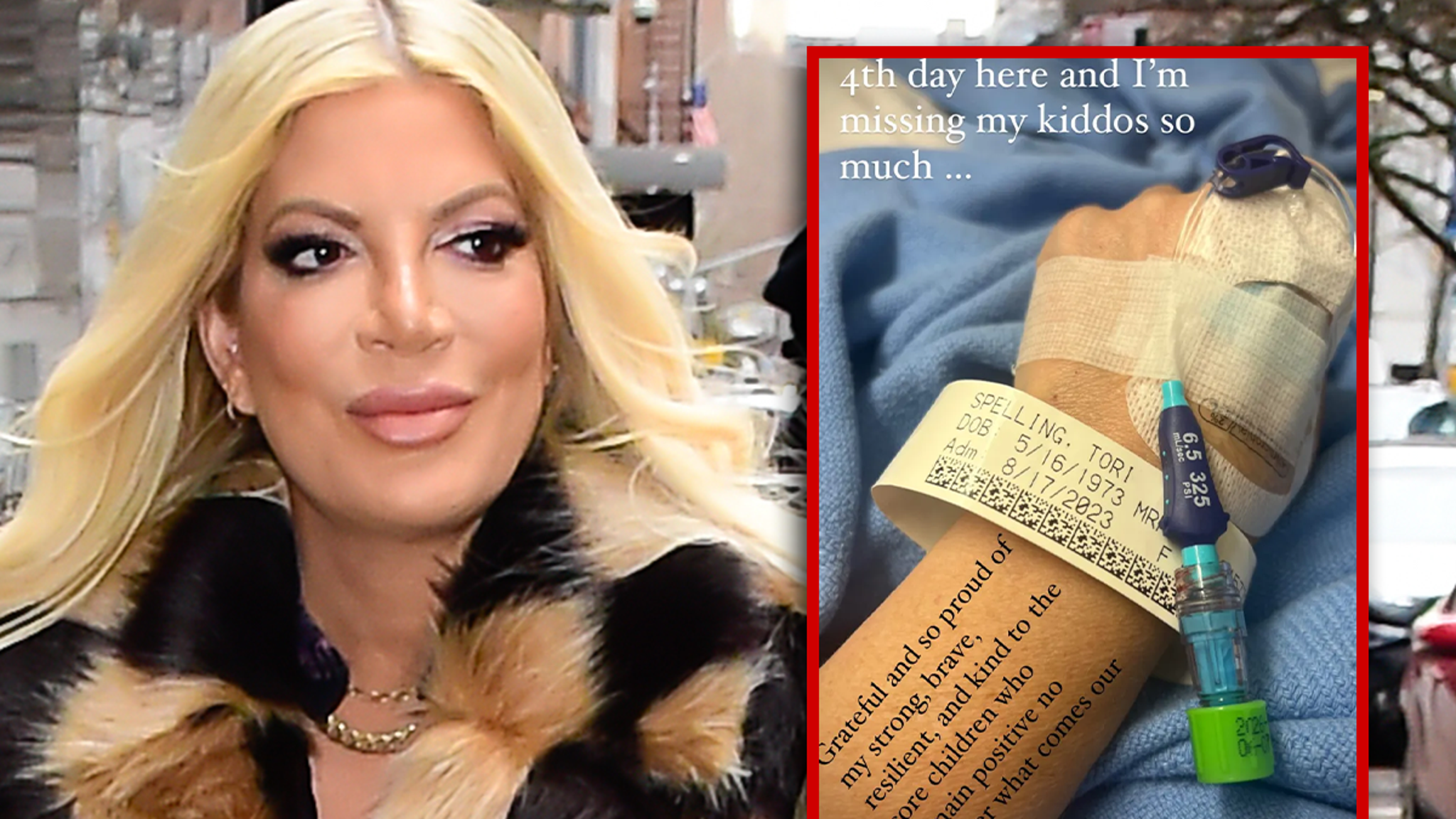 Tori Spelling hospitalisée lors de sa rupture avec Dean McDermott