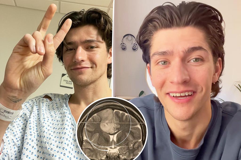 Barton Cowperthwaite révèle son diagnostic de cancer du cerveau à l’âge de 31 ans