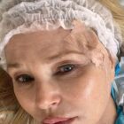 Christie Brinkley Reveals Skin Cancer Diagnosis, Shares Surgery Photos