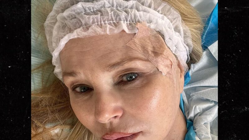 Christie Brinkley partage des photos choc de son combat contre un cancer de la peau
