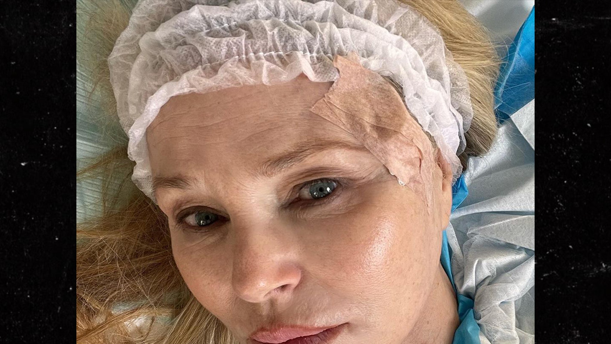 Christie Brinkley partage des photos choc de son combat contre un cancer de la peau
