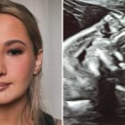 Gypsy-Rose Blanchard ultrasound