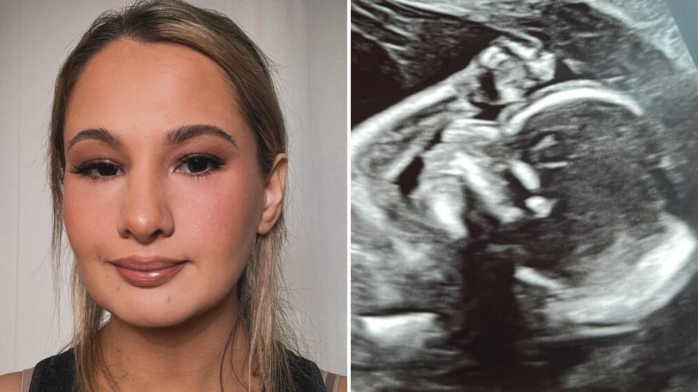 Gypsy-Rose Blanchard dévoile échographie : les fans remarquent un détail sur le bébé