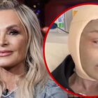 'RHOC' Tamra Judge Documents Brow Lift, Face Peel Post-Op