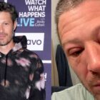 'Criminal Minds' Star Zach Gilford Is Unrecognizable with Shocking Swollen Face