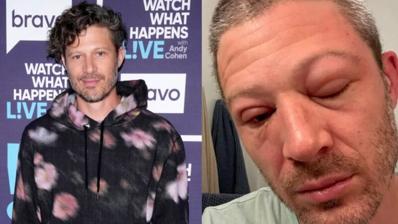Zach Gilford souffre d’un gros gonflement du visage après un problème de santé